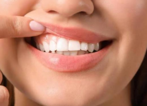 6 Ways To Protect Your Teeth During High Stress Periods